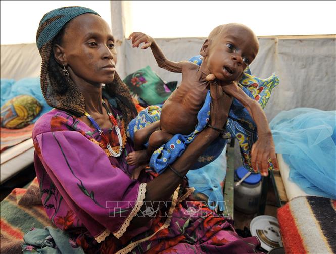 Trong ảnh: Trẻ em bị suy dinh dưỡng tại Tanout, nam Niger. Ảnh: AFP/TTXVN