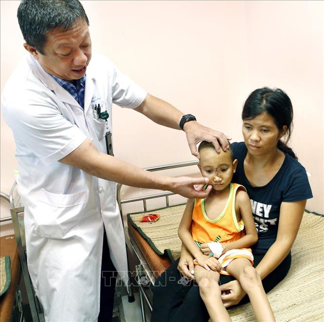 Bệnh viện Nhi Trung ương trở thành địa chỉ tin cậy về phẫu thuật Nhi khoa trong cả nước. Nhiều kỹ thuật cao, mới được triển khai thành như: là cơ sở đầu tiên ở Việt Nam tiến hành ghép thận cho trẻ em (năm 2004), ghép gan cho bệnh nhi. Đặc biệt, đây là đơn vị đầu tiên tiến hành phẫu thuật tim hở và can thiệp tim mạch. Trong đó đã mổ tim hở thành công cho nhiều trẻ sơ sinh và trẻ nhỏ. Trong ảnh: Phẫu thuật thành công ca bệnh hiếm gặp cho bé trai Rơ Chăng Khang (5 tuổi) bị thoát vị não nội sọ trước bẩm sinh. Ảnh: Dương Ngọc – TTXVN