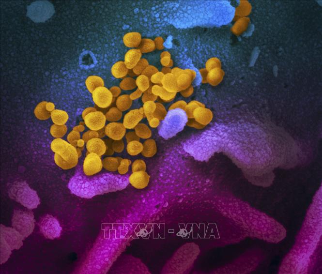 Trong ảnh: Hình ảnh do Viện nghiên cứu y tế quốc gia cung cấp cho thấy hình ảnh virus SARS-CoV-2 (màu vàng) gây dịch viêm đường hô hấp cấp COVID-19 nổi lên trên bề mặt tế bào (màu xanh, hồng) của một bệnh nhân COVID-19 ở Mỹ. Ảnh: AFP/TTXVN