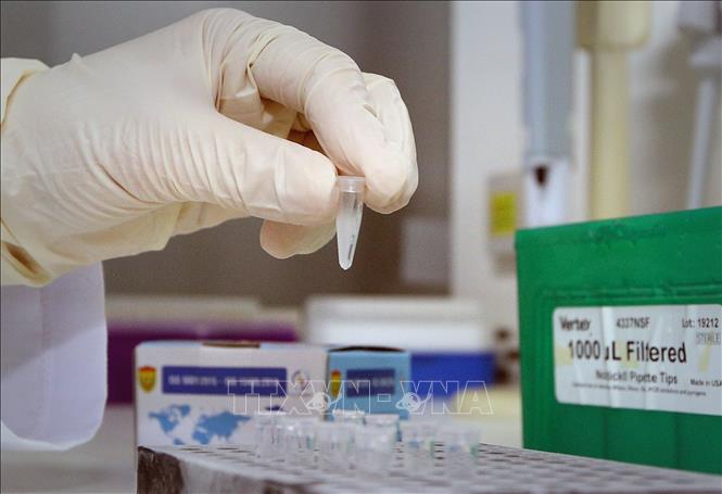 Trong ảnh: Test xác định virus SARS-CoV-2. Ảnh: Dương Giang - TTXVN


