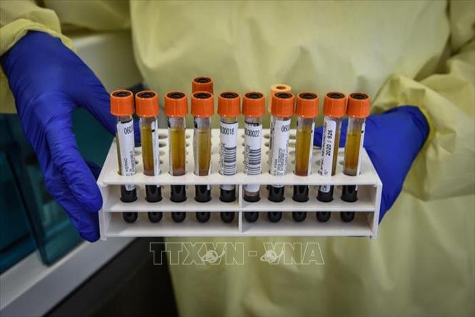 Trong ảnh: Các mẫu bệnh phẩm COVID-19 được sử dụng để nghiên cứu vaccine phòng ngừa dịch tại bệnh viện Spallanzani ở Rome, Italy. Ảnh: ANSA/TTXVN 