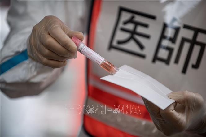 Trong ảnh: Nhân viên y tế lấy mẫu xét nghiệm PCR nhằm phát hiện người nhiễm COVID-19 tại Fujisawa, quận Kanagawa, Nhật Bản ngày 27/4/2020. Ảnh: AFP/TTXVN 