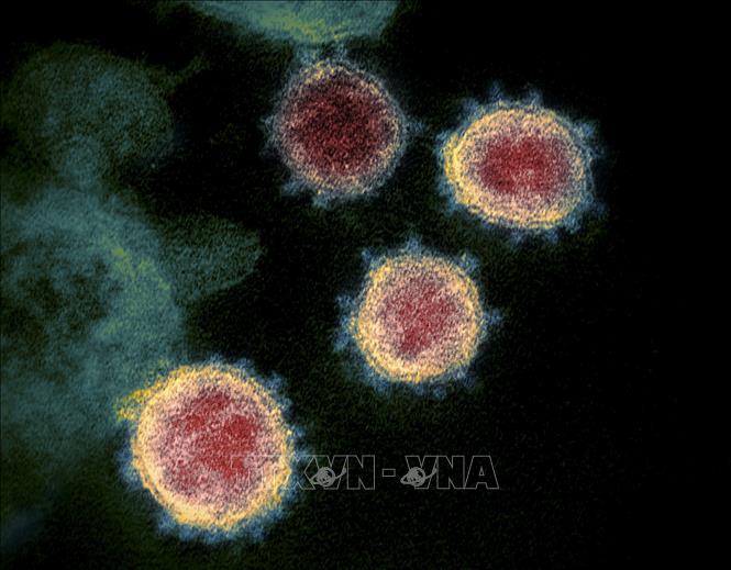 Trong ảnh: Hình ảnh nhìn qua kính hiển vi cho thấy virus SARS-CoV-2 (vật thể tròn màu xanh) nổi lên trên bề mặt tế bào bệnh nhân nhiễm COVID-19. Ảnh: AFP/TTXVN