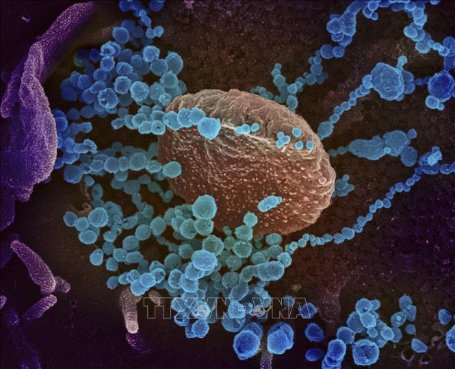 Trong ảnh: Hình ảnh quét qua kính hiển vi điện tử cho thấy virus SARS-CoV-2 (vật thể tròn màu xanh) nổi lên trên bề mặt tế bào bệnh nhân nhiễm COVID-19. Ảnh: AFP/TTXVN