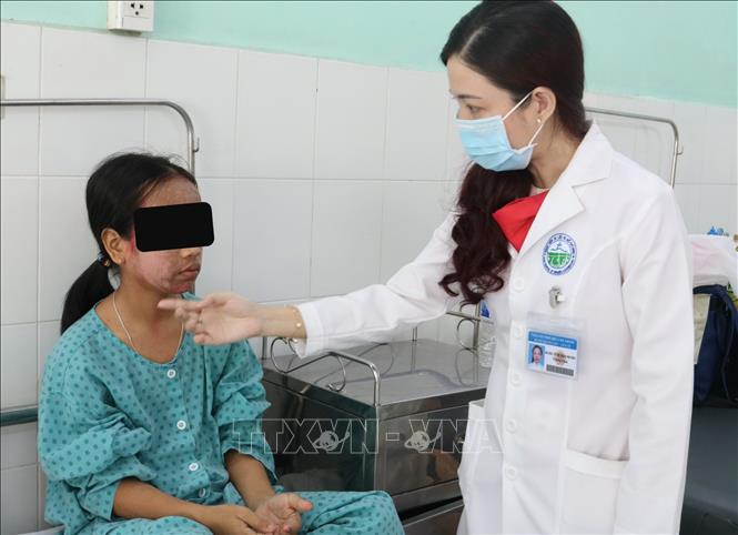 Trong ảnh: Bác sỹ Võ Thị Đoan Phượng, Trưởng Khoa Lâm sàng 1, Bệnh viện Da Liễu Thành phố Hồ Chí Minh khám cho bệnh nhân. Ảnh: TTXVN phát