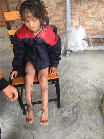 Photo: A landslide occuring in Ban Ho commune, Sa Pa town causes a Dao ethnic man, 27 years old, dead and his wife and two childs injured.