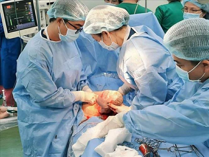 Trong ảnh: Các bác sỹ Bệnh viện Hùng Vương và Bệnh viện Nhi đồng Thành phố phối hợp phẫu thuật lấy thai an toàn cho bệnh nhi. Ảnh: TTXVN phát