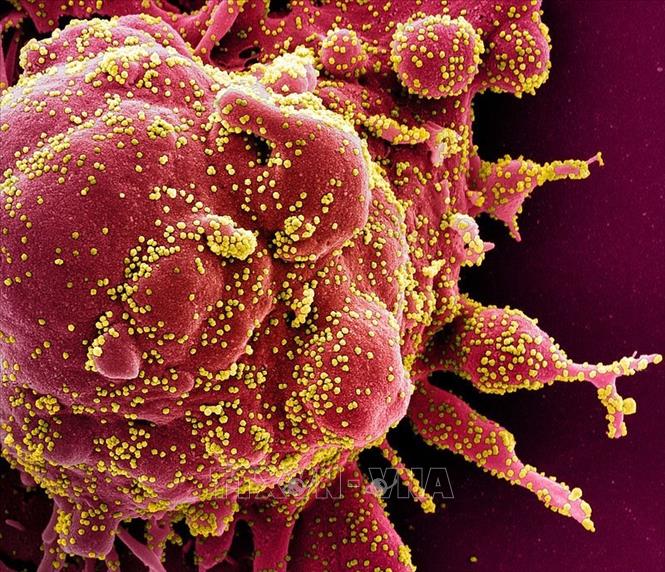 Trong ảnh: Hình ảnh quét qua kính hiển vi điện tử cho thấy một tế bào (màu đỏ) bị virus SARS-COV-2 (màu vàng) xâm nhập, lấy từ mẫu bệnh phẩm của bệnh nhân COVID-19. Ảnh: AFP/ TTXVN