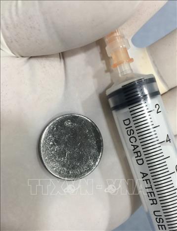 Trong ảnh: Đồng xu được nội soi gắp ra khỏi cơ thể bé gái 4 tuổi do nuốt phải trong lúc chơi đùa. Ảnh: TTXVN phát