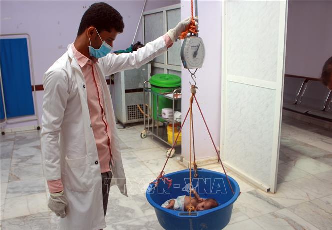Trong ảnh: Trẻ em bị suy dinh dưỡng được điều trị tại một trung tâm y tế ở Hajjah, Yemen, ngày 5/7/2020. Ảnh: AFP/TTXVN