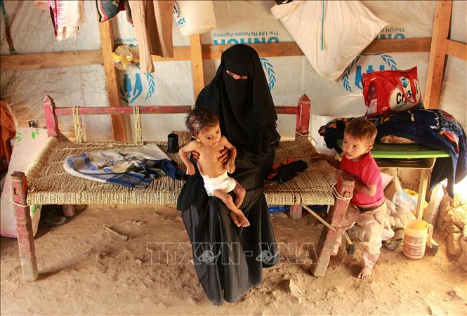 Trong ảnh: Trẻ em bị suy dinh dưỡng do nạn đói kéo dài ở Hajjah, Yemen. Ảnh: AFP/TTXVN