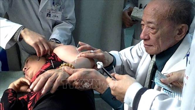 Trong ảnh: Giáo sư Nguyễn Tài Thu châm cứu cho bệnh nhân. Ảnh: TTXVN
