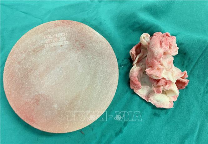 Trong ảnh: Túi ngực và miếng gạc y tế bị 