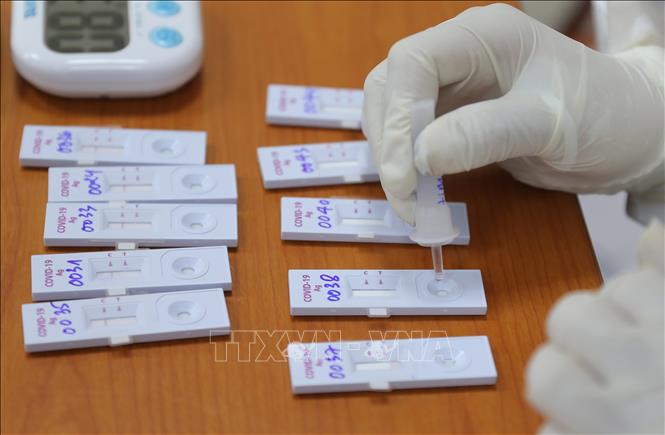 Trong ảnh: Mẫu phẩm xét nghiệm COVID-19 của công nhân viên Bến xe Giáp Bát, sáng 15/3. Ảnh: Hoàng Hiếu  - TTXVN