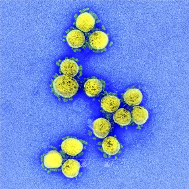 Trong ảnh (tư liệu): Hình ảnh quét qua kính hiển vi điện tử cho thấy virus SARS-CoV-2 lấy từ mẫu bệnh phẩm của bệnh nhân COVID-19 tại Viện Nghiên cứu Dị ứng và Bệnh truyền nhiễm quốc gia, Fort Detrick, Maryland, Mỹ, ngày 11/8/2020. Ảnh: AFP/ TTXVN