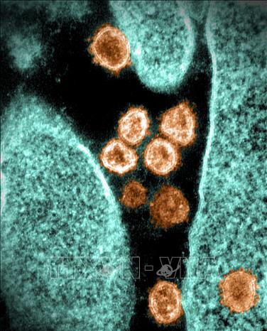 Trong ảnh (tư liệu): Hình ảnh từ kính hiển vi do Viện nghiên cứu bệnh truyền nhiễm và dị ứng quốc gia Mỹ cung cấp cho thấy virus SARS-CoV-2 gây bệnh COVID-19 trong mẫu bệnh phẩm tại phòng thí nghiệm ở Hamilton, Montana (Mỹ). Ảnh: AFP/TTXVN