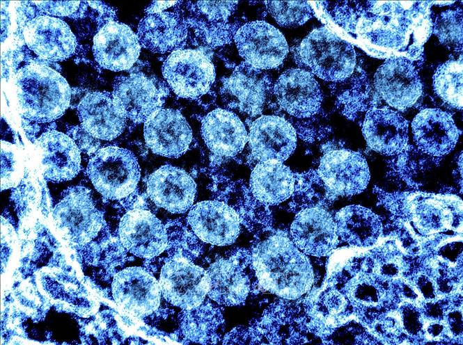 Trong ảnh: Hình ảnh từ kính hiển vi do Viện nghiên cứu bệnh truyền nhiễm và dị ứng quốc gia Mỹ cung cấp cho thấy virus SARS-CoV-2 trong mẫu bệnh phẩm của bệnh nhân mắc COVID-19. Ảnh: AFP/TTXVN