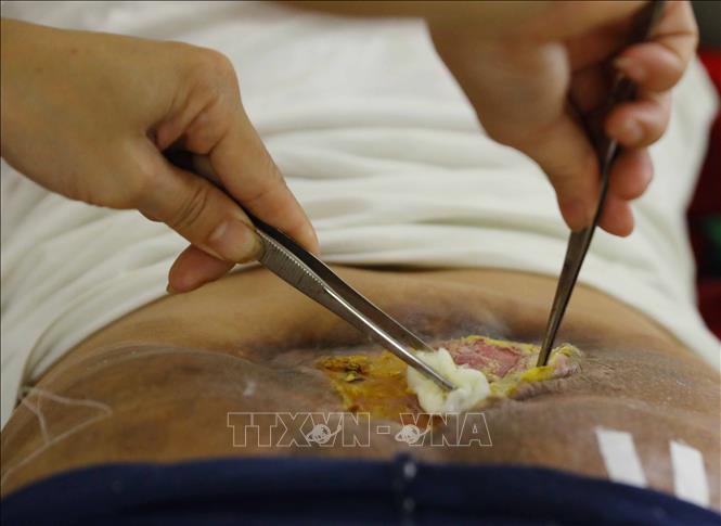 Các vết thương phần cột sống do phải nằm nhiều nên gây nhiều đau đớn những khi trái gió trở trời, khó khăn trong việc chăm sóc cho thương bệnh binh trung tâm. Ảnh: Hoàng Hiếu - TTXVN 