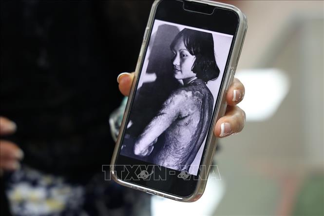 Hình ảnh bà Kim Phúc với những vết sẹo cháy da thịt của bom napalm. Ảnh: Lê Phú - TTXVN
