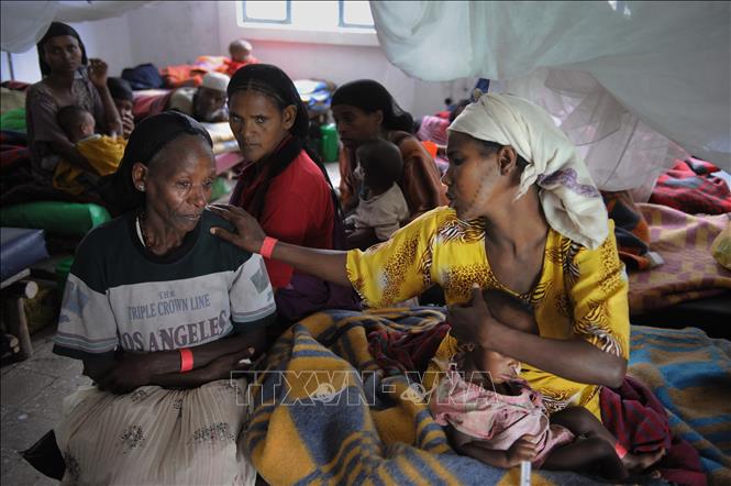 (tư liệu) Trẻ em bị suy dinh dưỡng được điều trị tại trung tâm y tế ở Kuyera,  Ethiopia. Ảnh: AFP/TTXVN