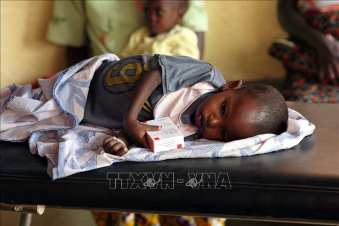 Một em nhỏ suy dinh dưỡng được điều trị tại bệnh viện ở Diapaga, Burkina Faso. Ảnh: AFP/TTXVN