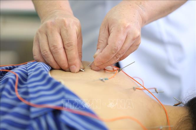 Trong ảnh: Sử dụng phương pháp Điện châm điều trị cho bệnh nhân tại Bệnh viên Y học cổ truyền tỉnh Lạng Sơn. Ảnh: Anh Tuấn - TTXVN