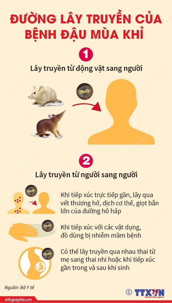 Đường lây truyền của bệnh Đậu mùa khỉ