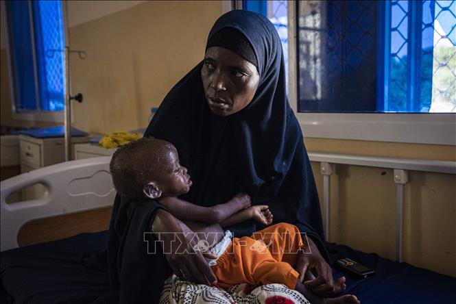 (tư liệu) Trẻ em bị suy dinh dưỡng điều trị tại một bệnh viện ở Mogadishu, Somalia. Ảnh: AFP/TTXVN