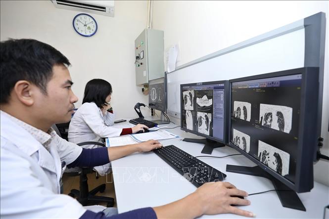 Phim chụp sẽ được đọc trực tiếp trên máy tính và lưu vào hệ thống phần mềm quản lý bệnh viện chung, giúp thuận tiện cho bác sĩ và bệnh nhân rút ngắn thời gian chờ đợi. Ảnh: Minh Quyết – TTXVN