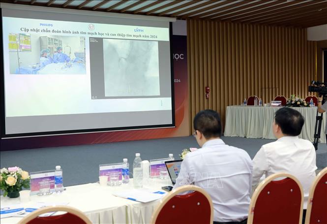 Truyền hình trực tiếp ca chụp can thiệp tim mạch từ phòng can thiệp tim mạch của Bệnh viện Hữu Nghị Lạc Việt do các bác sĩ Viện Tim mạch Việt Nam cùng các bác sĩ Bệnh viện Hữu Nghị Lạc Việt. Ảnh: Hoàng Hùng -TTXVN

