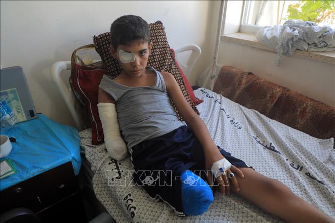 Em nhỏ Palestine bị thương trong cuộc xung đột Israel-Hamas được điều trị tại bệnh viện ở Khan Younis, phía Nam Dải Gaza ngày 19/6/2024. Ảnh: THX/TTXVN