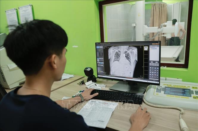 Phòng chụp X-Quang phục vụ bệnh nhân tới 21h. Ảnh: Minh Quyết - TTXVN
