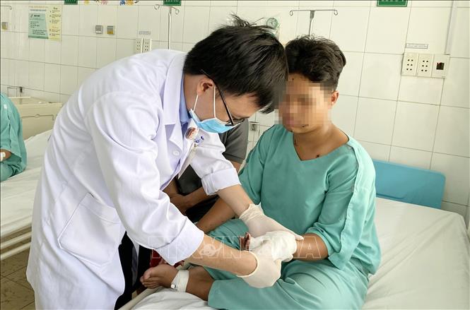 Bác sĩ kiểm tra vết thương cho bệnh nhi N.V.S, ngụ tại xã Sông Trầu (Trảng Bom, Đồng Nai), bị dập nát bàn tay trái, phải cắt bỏ 3 ngón tay do chơi pháo nổ. Ảnh: Lê Xuân - TTXVN