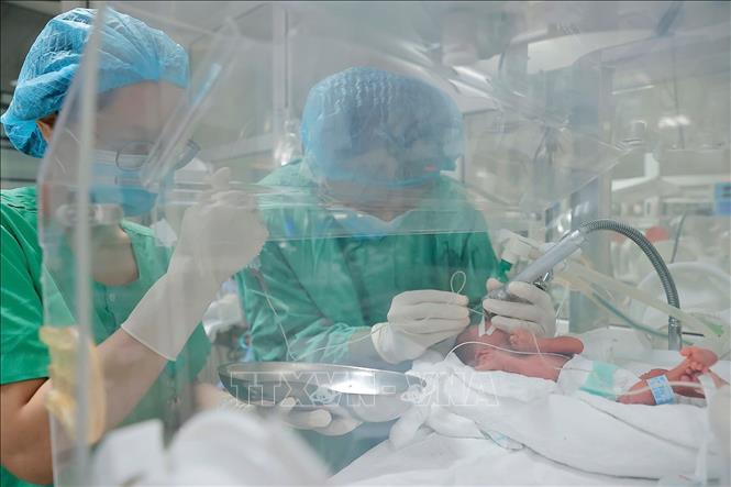 Bác sĩ bệnh viện Phụ sản Trung ương áp dụng kỹ thuật bơm surfactant không xâm lấn cho bệnh nhi, sử dụng ống xông chuyên dụng bơm surfactant vào phổi cho em bé. Ảnh: Minh Quyết - TTXVN