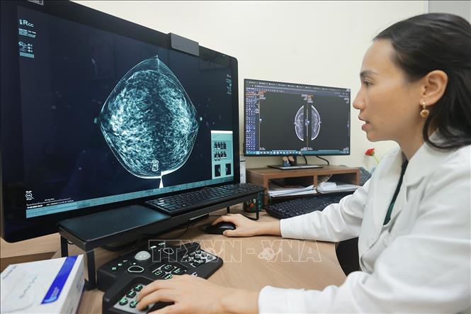 Trạm xử lý hình ảnh ứng dụng trí tuệ nhân tạo giúp phát hiện tổn thương vú siêu nhỏ, cấp độ mm. Ảnh: Minh Quyết – TTXVN