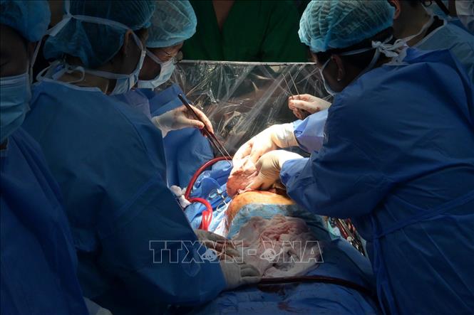 Ê kíp phẫu thuật ghép phổi cho bệnh nhân Thư vào đêm 30 Tết Giáp Thìn. Ảnh: TTXVN phát