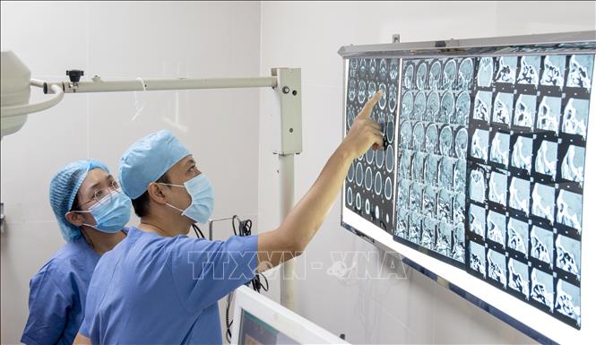Các bác sĩ quan sát vị trí của dị vật trên phim chụp CT trước khi tiến hành phẫu thuật lấy dị vật ra khỏi hốc mắt người bệnh. Ảnh: TTXVN phát