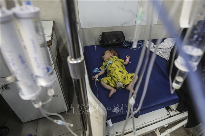 Điều trị cho em nhỏ bị suy dinh dưỡng tại Bệnh viện nhi đồng Abdulaziz er-Rantisi ở thành phố Gaza, ngày 24/7/2025. Ảnh: Anadolu Agency/TTXVN