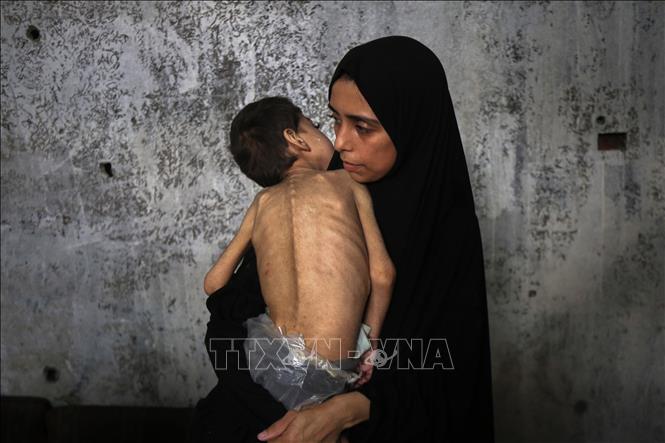 Trẻ em Palestine bị suy dinh dưỡng tại thành phố Gaza, ngày 25/7/2025. Ảnh: THX/TTXVN