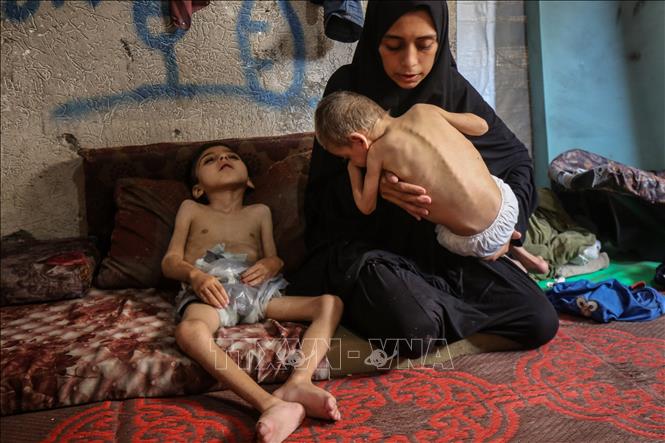 Các em nhỏ bị suy dinh dưỡng tại Gaza. Ảnh: THX/TTXVN