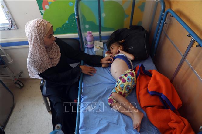 Em nhỏ bị suy dinh dưỡng được điều trị tại bệnh viện ở Gaza. Ảnh: THX/TTXVN