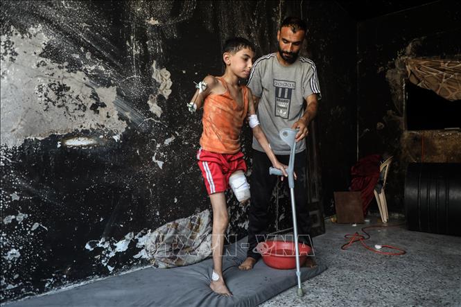 Ngày 3/9/2025, Ủy ban Liên hợp quốc (LHQ) về Quyền của Người Khuyết tật cho biết có ít nhất 21.000 trẻ em ở Gaza đã bị khuyết tật kể từ khi nổ ra cuộc xung đột giữa Israel và lực lượng Hamas ngày 7/10/2023. Tổng cộng, ủy ban này cho biết đã được thông báo về ít nhất 157.114 người bị thương liên quan đến xung đột Hamas-Israel, với hơn 25% trong số này có nguy cơ bị suy giảm chức năng suốt đời. Ảnh: THX/TTXVN