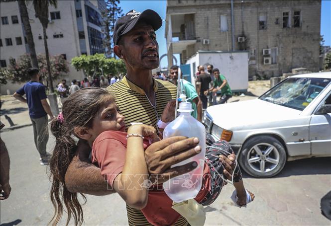 Em nhỏ bị thương sau cuộc không kích của Israel tại Gaza. Ảnh: THX/TTXVN