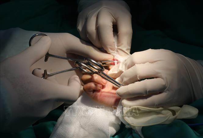 Phẫu thuật tay cho trẻ em khuyết tật có hoàn cảnh khó khăn trên địa bàn tỉnh Lạng Sơn năm 2025. Ảnh: Anh Tuấn - TTXVN