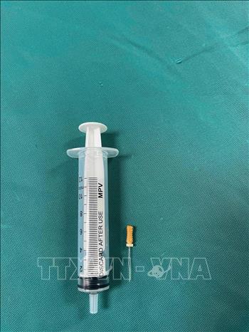 Hình ảnh chiếc kim chọc tuỷ rơi vào trong đường thở của bé trai 3 tuổi. Ảnh: TTXVN phát