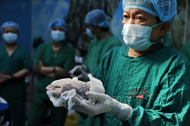 TTƯT.TS.BSCC Đinh Văn Lượng, Bí thư Đảng uỷ, Giám đốc Bệnh viện Phổi Trung ương trực tiếp tham gia ghép phổi cho bệnh nhân. Ảnh: Minh Quyết – TTXVN