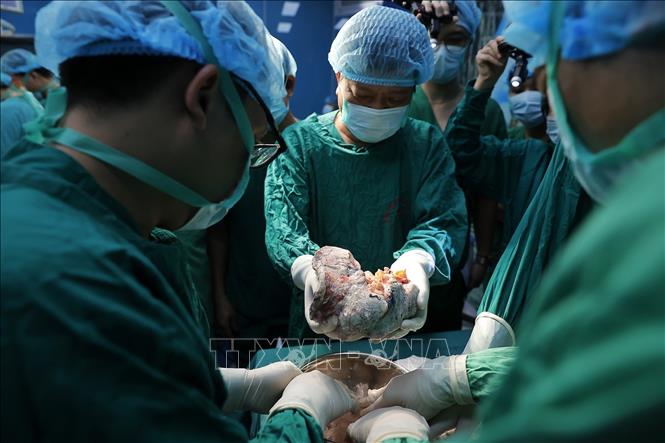 Khi đến nơi, ngay lập tức Ê kíp tiến hành kiểm tra, rửa phổi và ghép cho bệnh nhân. Ảnh: Minh Quyết -–TTXVN