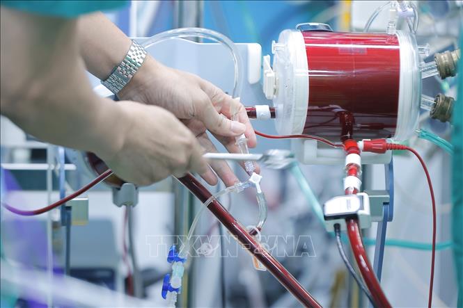 Đặt ECMO là kỹ thuật hỗ trợ tạm thời chức năng tim và phổi cho bệnh bằng cách rút máu ra ngoài, qua màng lọc cung cấp oxy và loại bỏ CO2, rồi bơm máu trở lại cơ thể. Ảnh: Minh Quyết – TTXVN