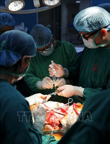 Ê kíp tiến hành đặt ECMO (hệ thống tim phổi nhân tạo), chuẩn bị ghép phổi cho bệnh nhân. Ảnh: Minh Quyết - TTXVN