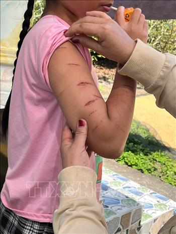 Sự việc chỉ được phát hiện khi em T.T.N, học sinh lớp 5 Trường tiểu học 1 Khánh Bình Tây Bắc, đi học với nhiều vết thương trên người. Ảnh: TTXVN phát